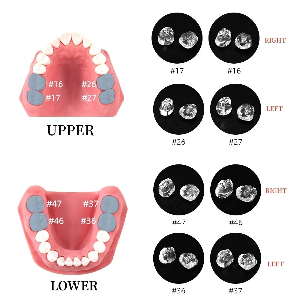 1set Dental Posterior Teeth Aesthetic Printing Mould Kit for Light Cure Composite Restoration Filling Tools Dentistry