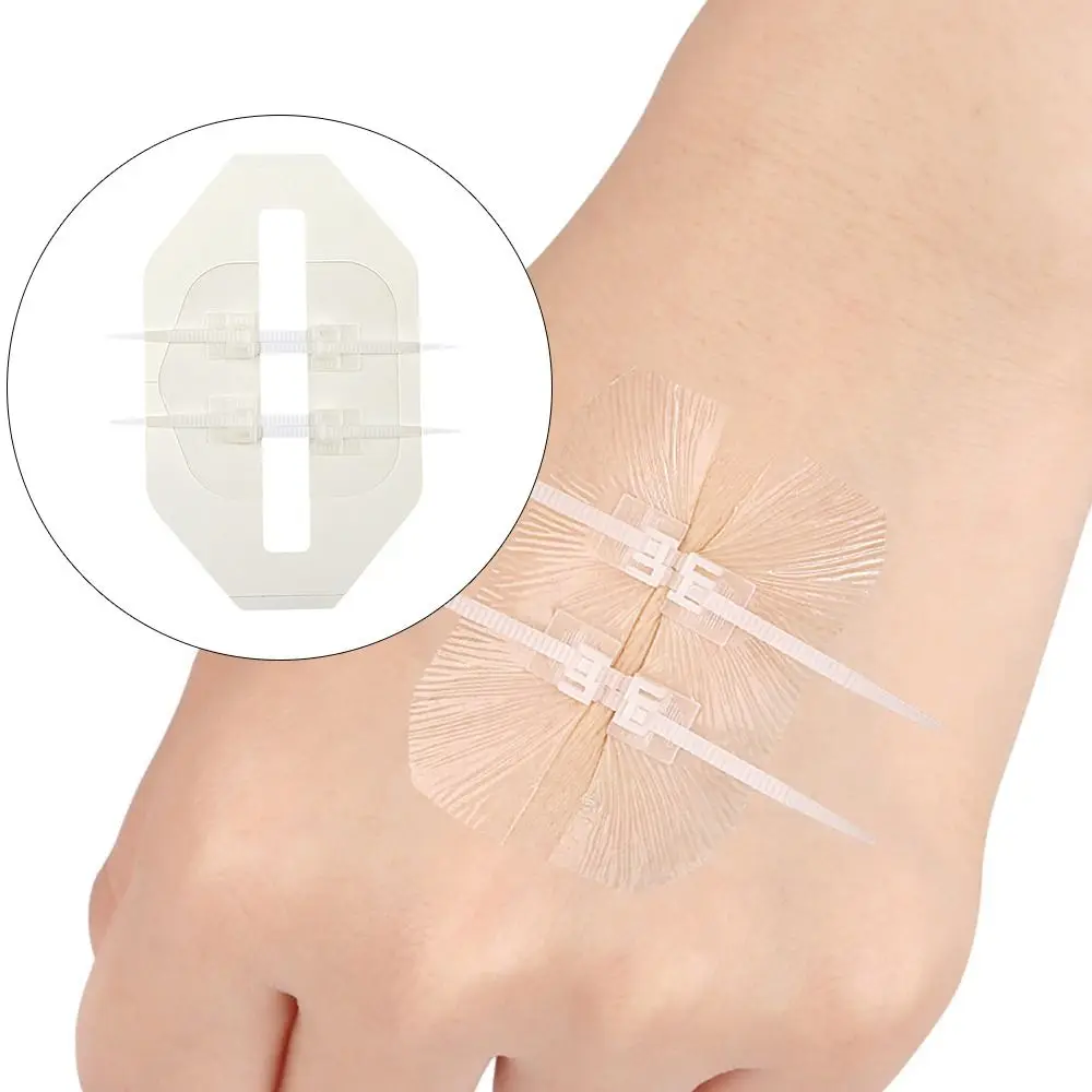 Adhesive Wound Care Zip Sutures Bandaids Without Stitches First Aid Zipper Laceration Repair Emergency Laceration Repair