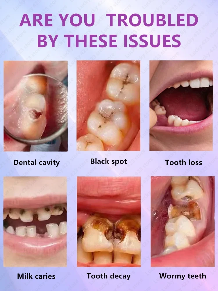 Prevent Tooth Decay