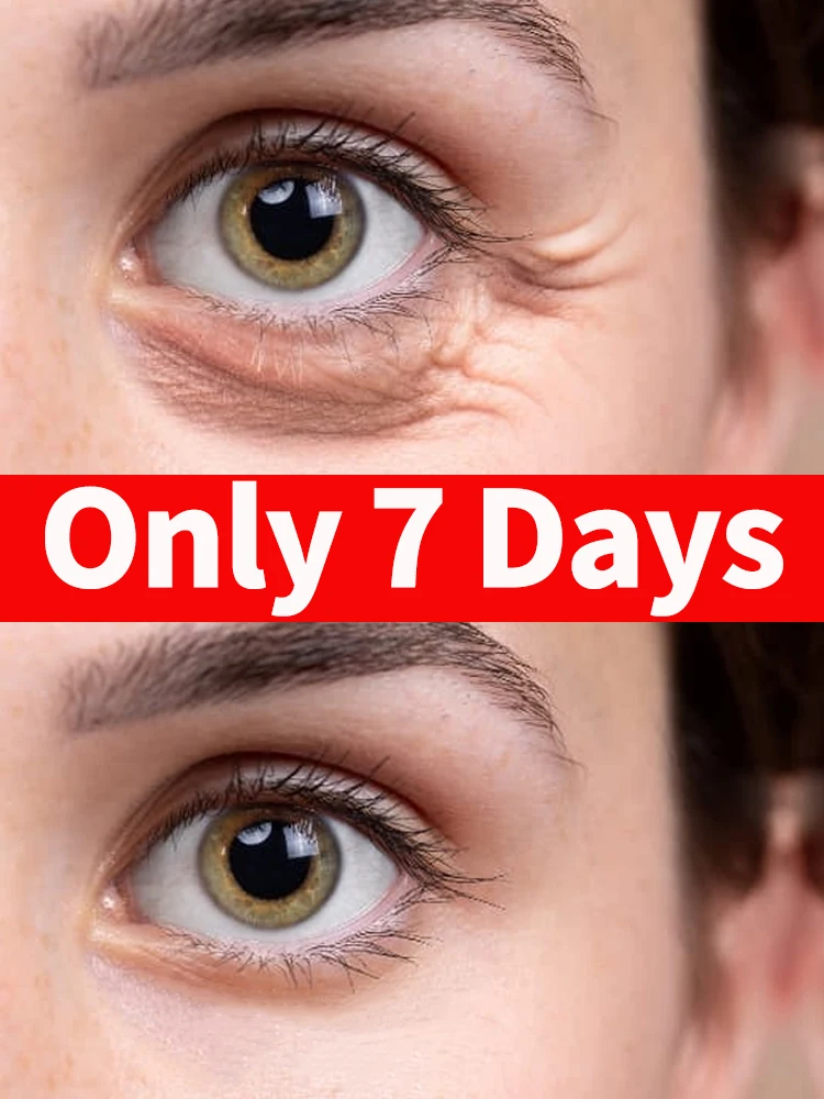 

Solve your Eye Problems