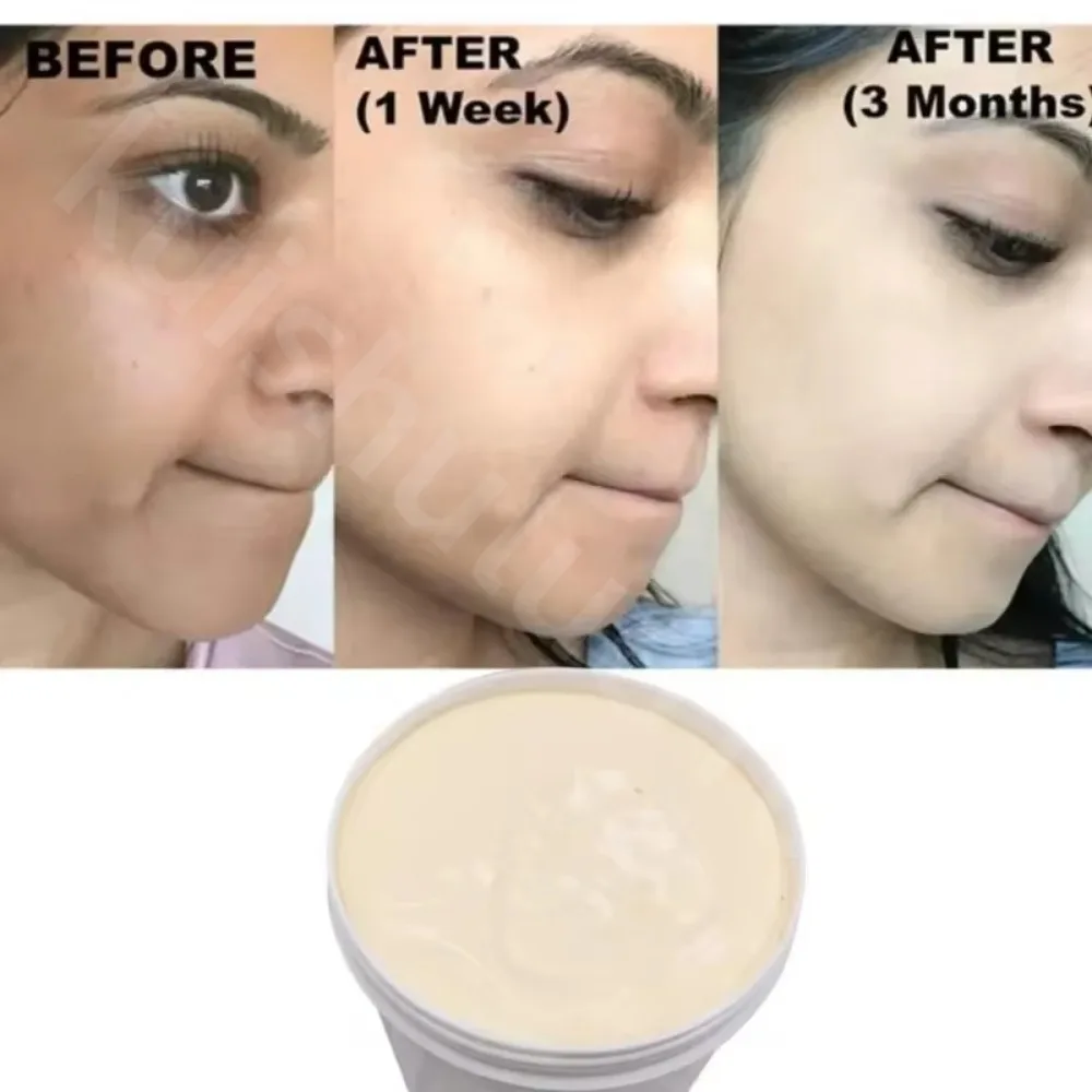 Strong Effective Best Bleaching Ginseng Whitening Cream Facial Neck Hands Feet Without Side Effects Dark Black Brighten SkinCare