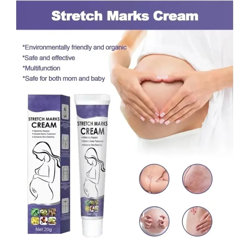 HEISSE sanfte Hautpflege verbessert die Elastizität, wirksam nach der Schwangerschaft, Entfernung von Dehnungsstreifen, leistungsstarke Mutterschaftscreme, nährt die Haut