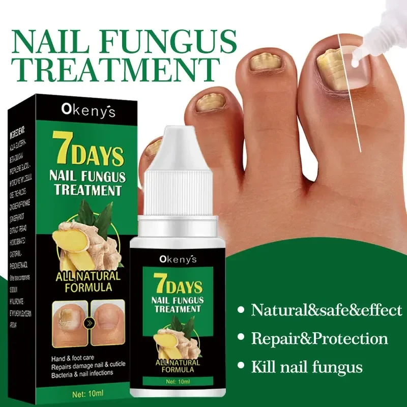 Sérum de traitement des champignons des ongles, bain supplémentaire, huile d'essence, réparation des pieds, crème de soin, anti-infection, élimination des champignons, Parker, N64.