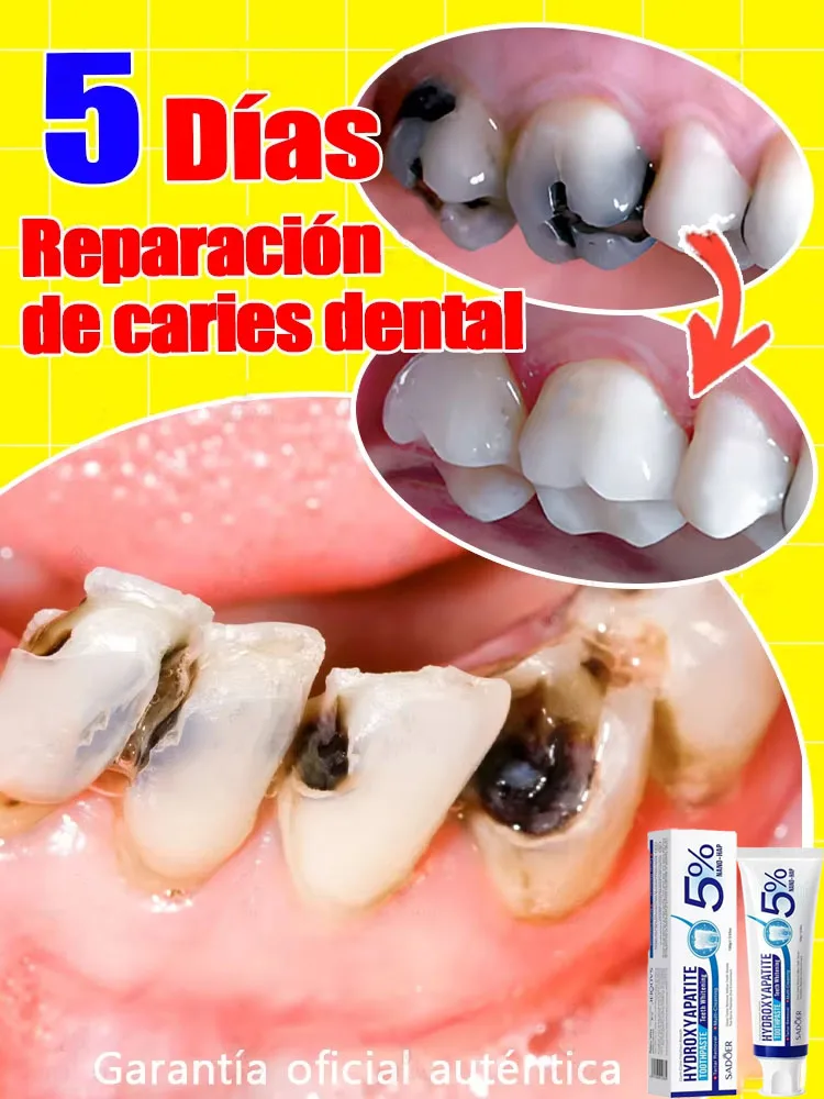 يصلح بسهولة على تسوس الأسنان ويمنع تساقط الأسنان وتبييض الأسنان.