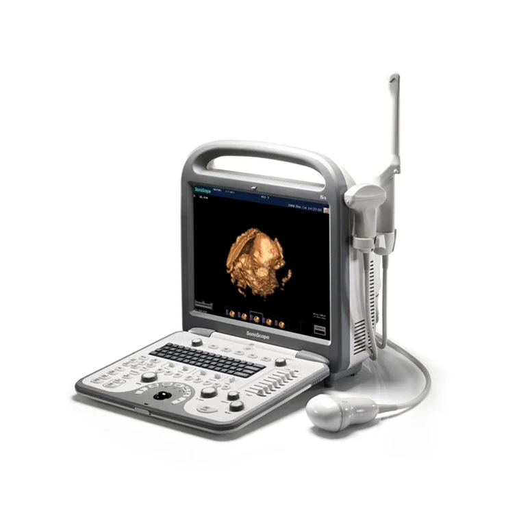 Human Software Sonoscape S8 4D Ultrasound Professional Tool For Outdoor And Hospital Use Color Flow