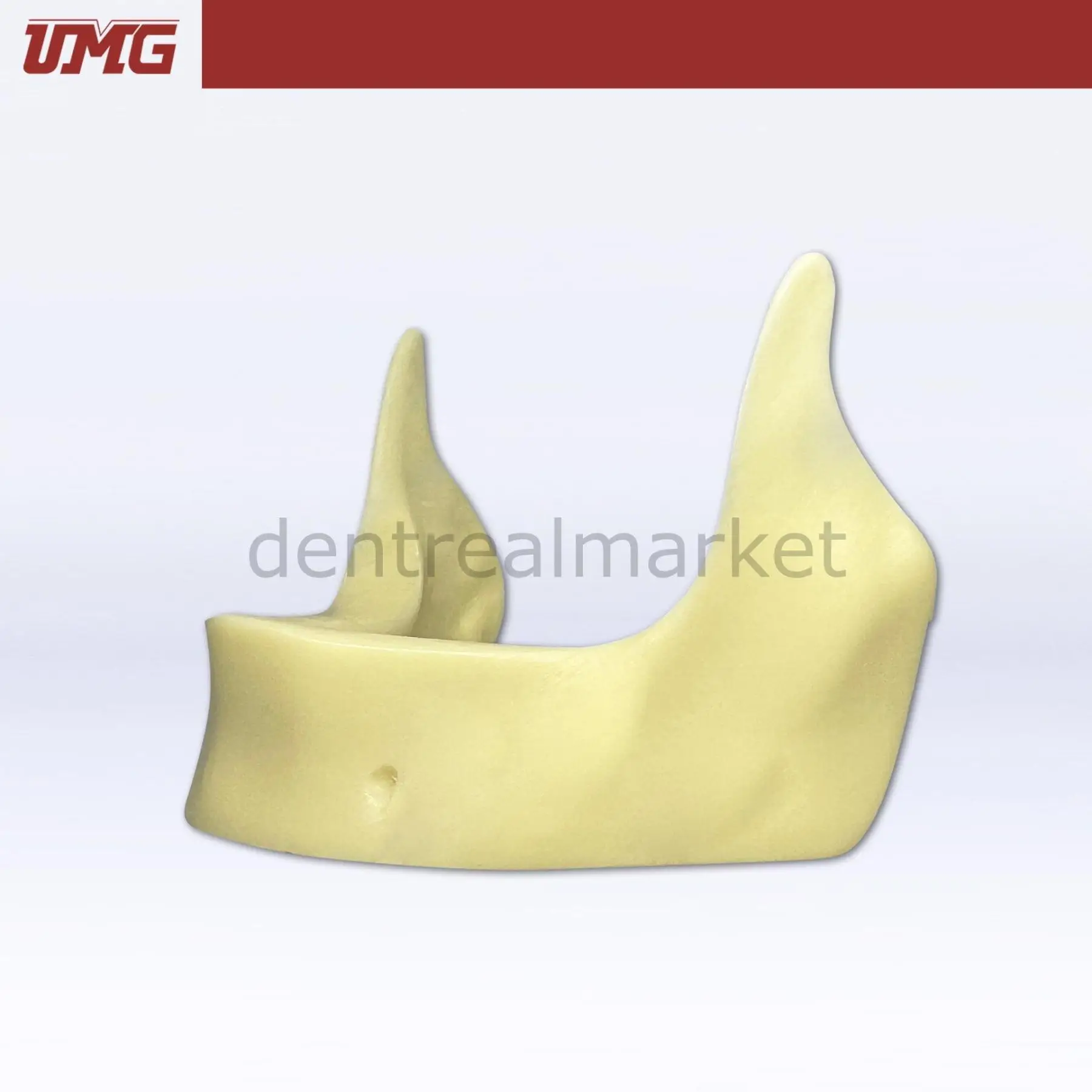 UMG Dental - Umg Model Implant Application Training Model - UM-Z2025