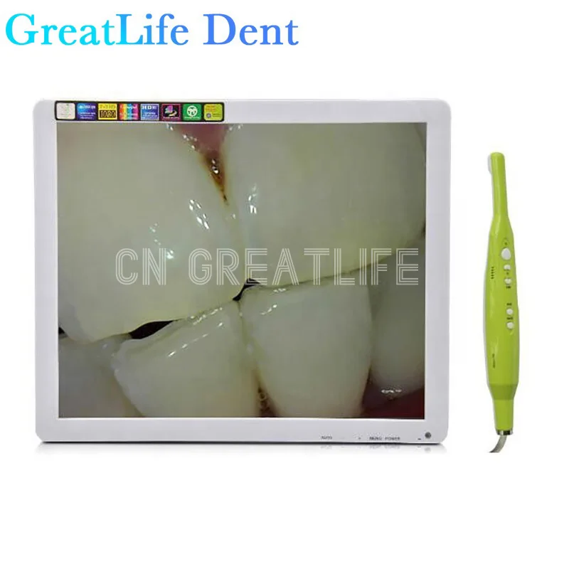 GreatLife 17 Inch Dental Unit Type PIP USB Oral Camera Intraoral Intraoral Camera Monitor Intra Oral Camera Auto Focus