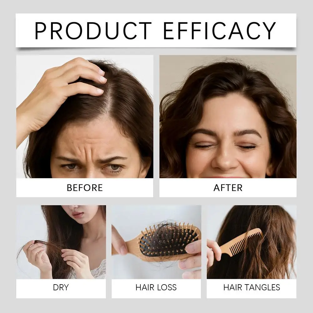0.25mm Hair Essential Serum Micro-needle Roller Set Hair Follicle Nourishing Scalp Hair Care Hair Thicken Conditioner Essence - view 5