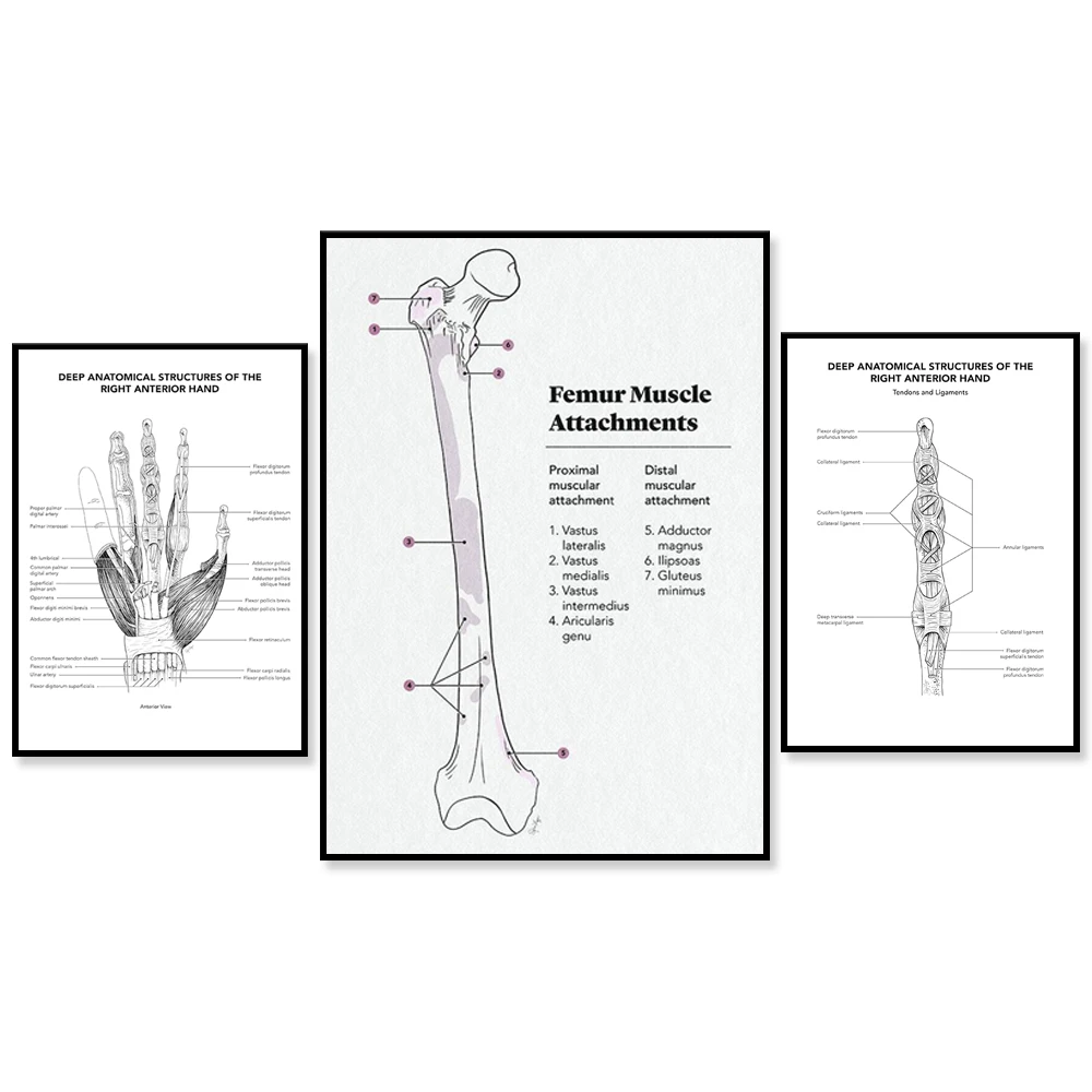 Femoral Muscle Attachment Medical Poster, Right Anterior Hand Medical Deep Anatomy Canvas Poster, Orthopedic Doctor Gift