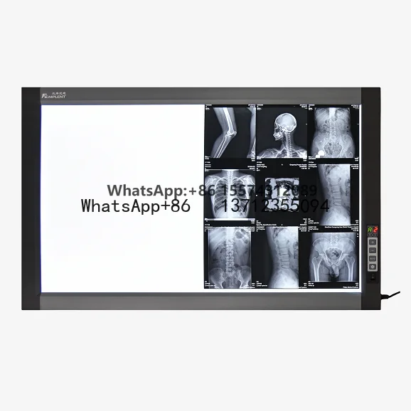 Profession elle wirtschaft liche Krankenhaus Bagihrte Röntgen Röntgen Visionneuse de film Negatos kop Röntgen HFZG-D