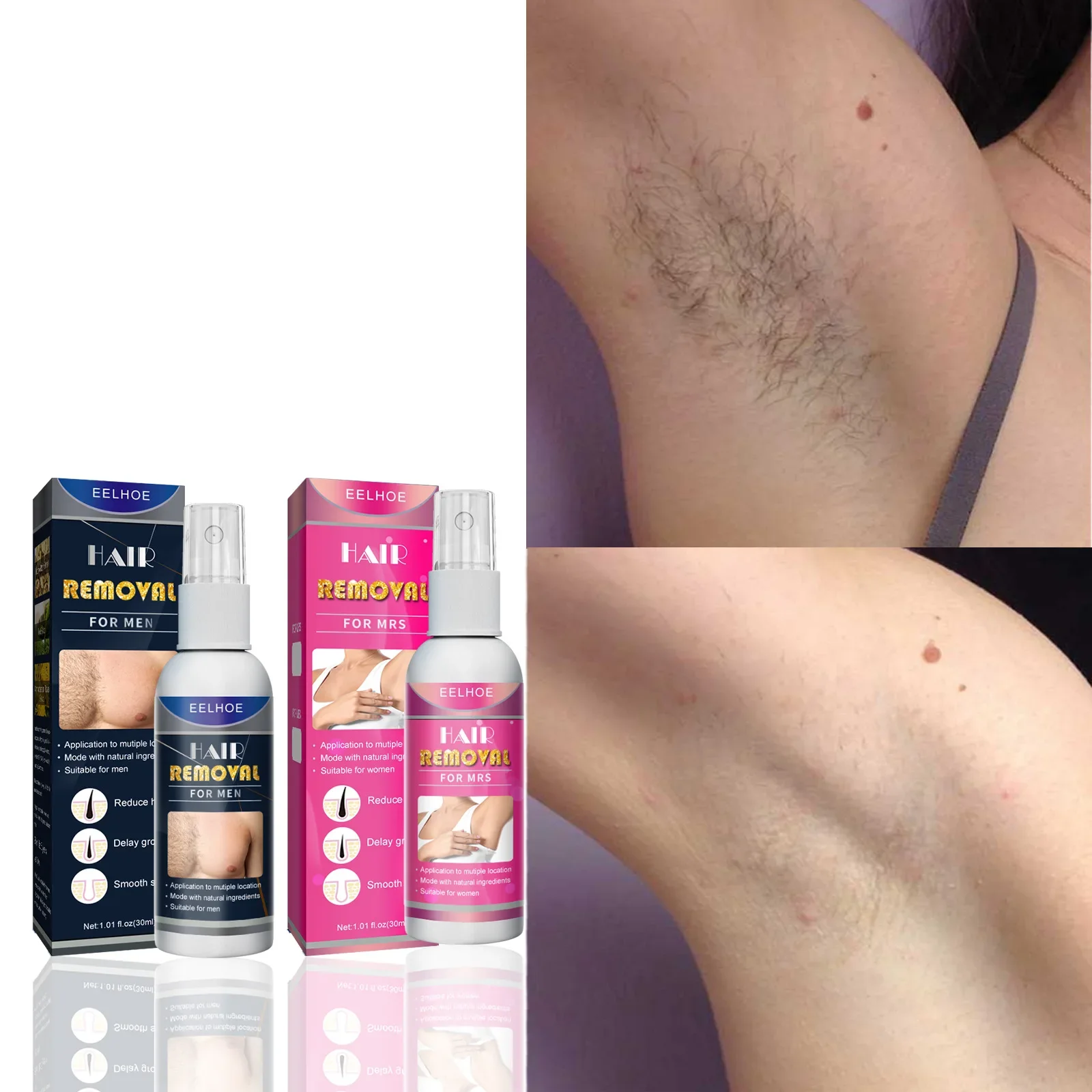 Permanant Hair Removal Spray Painless Hair Remover Hair Growth Inhibitor Armpit Legs Arms Smooth Nourishes Repair Care Man Women