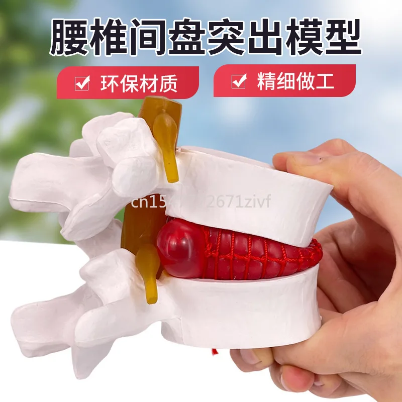 Intervertebral Disc Model Genuine Medical Human Lumbar Spine Prominent Spine Spine Pathology Demonstration Joint Standard Model