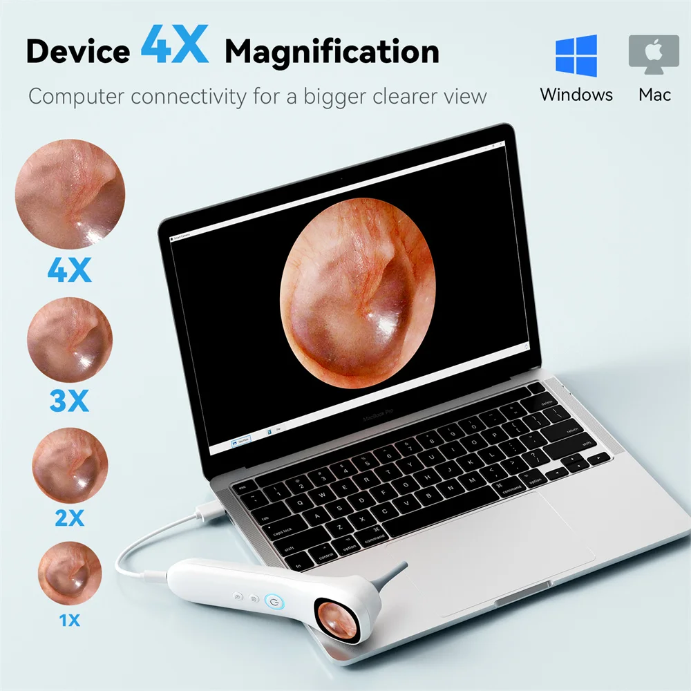 كاشف ذكي 5 في 1 مزود بكاميرا أذن عالية الدقة 1080 بكسل يتضمن مجموعة اختيار الأذن وستة نصائح بديلة و12 رأس فحص إضافي