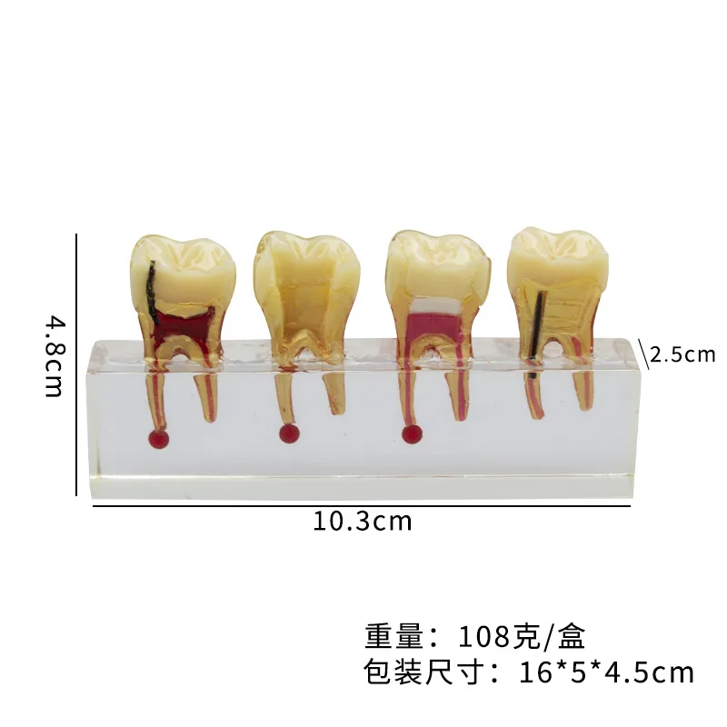 Dental Educational Model for Communication and Demonstration: Pediatric Model Featuring Primary Teeth Cavities and Pulp Repair