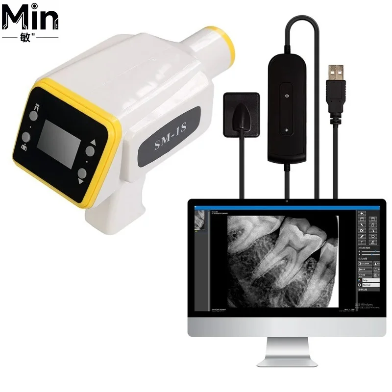 Portable Digital  X-ray Machine 0.3 Second Fast Imaging for Human and Animal Veterinary Medical Use CE Certified