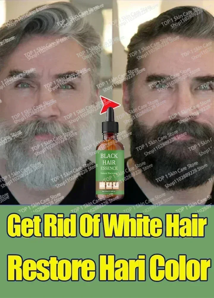 White Hair Killer, permanently removes white hair, restores natural hair color in 7 days R