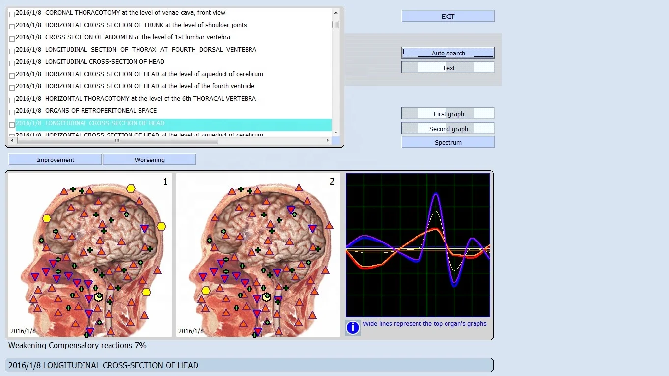 2024 مصنع 296 قطعة 3.82 نسخة الإنجليزية الألمانية الفرنسية الإيطالية الأصلية Bioplasm 9D Nls محلل الصحة