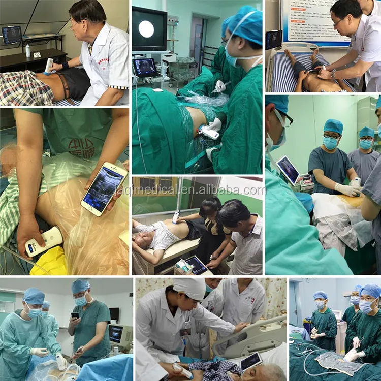 JQ-5T-wireless transvaginal probe for gynecological follicle testing, uterine examination and visualization guidance