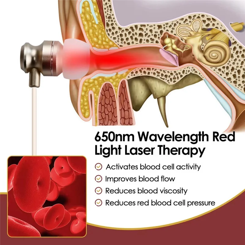 

APPLIA-Earplug Ear Canal Laser Line 650Nm Wavelength Physiotherapy Balance Otitis Media Deafness Treatment