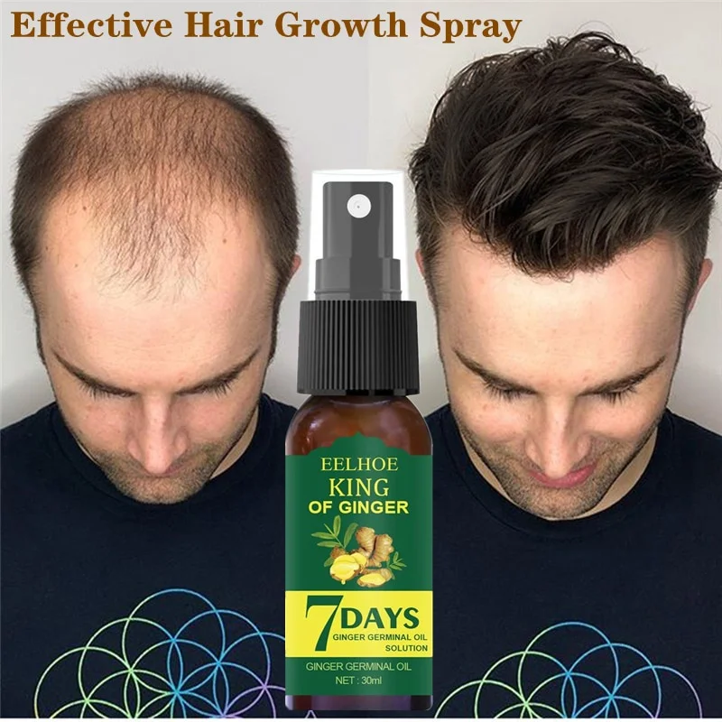 EELHOE Hair Growth Essence Germinal Serum Essence Oil Natural Hair Loss Treatement Effective Fast Growth Scalp Treatment Men Wom