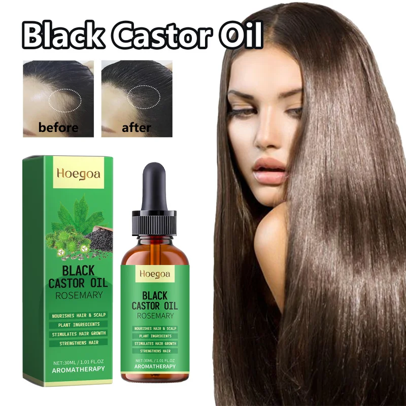 

Black Castor Hair Oil - Nourishes Scalp, Strengthens Hair Roots, Reduces Breakage & Adds Shine For Healthier Looking Hair