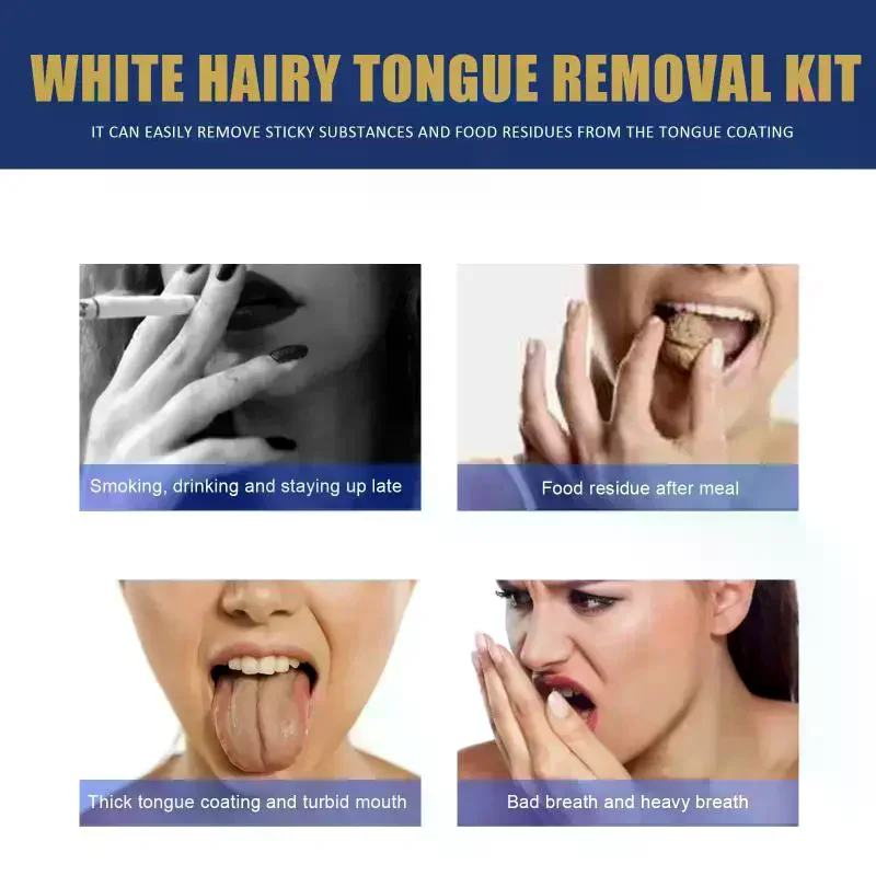 Tongue Clean Paste Set Scraping Artifact Fresh Breath Remove Oral Odor Mouth Cleaner Tongue Coating Removal Gel With Brush