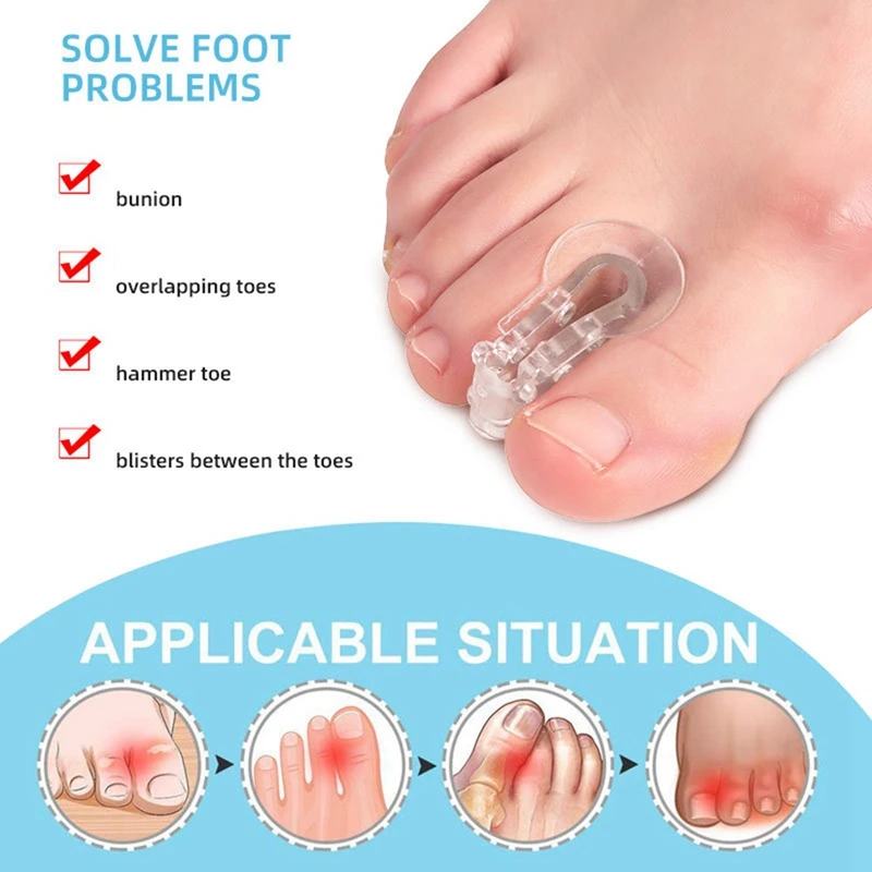 Separadores de juanete, Corrector ortopédico de Gel para juanetes, dedos superpuestos, Hallux Valgus, 3,5X2Cm, 10 paquetes