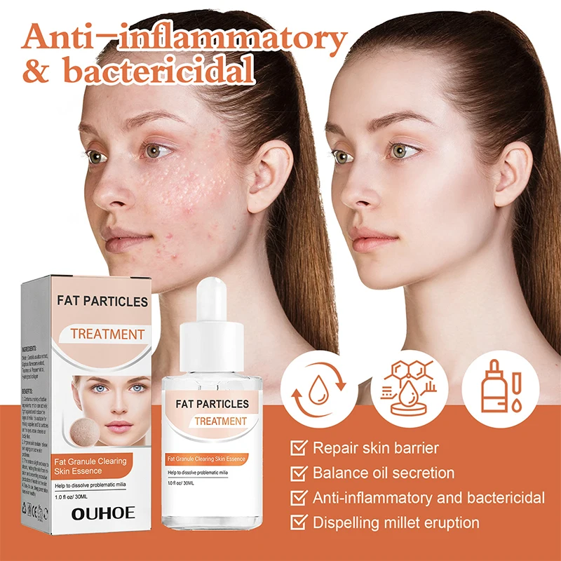 Fett granulat verblassen feine Linie Essenz Entfernung Augen serum Anti Dark Circle Augen taschen Anti-Puffiness feuchtigkeit spendende Hautpflege produkte