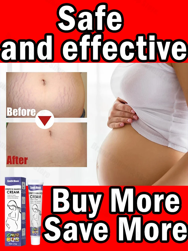 

Improve Pregnancy Stretch Marks Cream