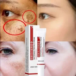 Powerful Spot-removing Whiten Cream Fast Eliminates Melanin Pigmentation Melasma Dark Spots Brighten Skin Korean Skin Care 2024