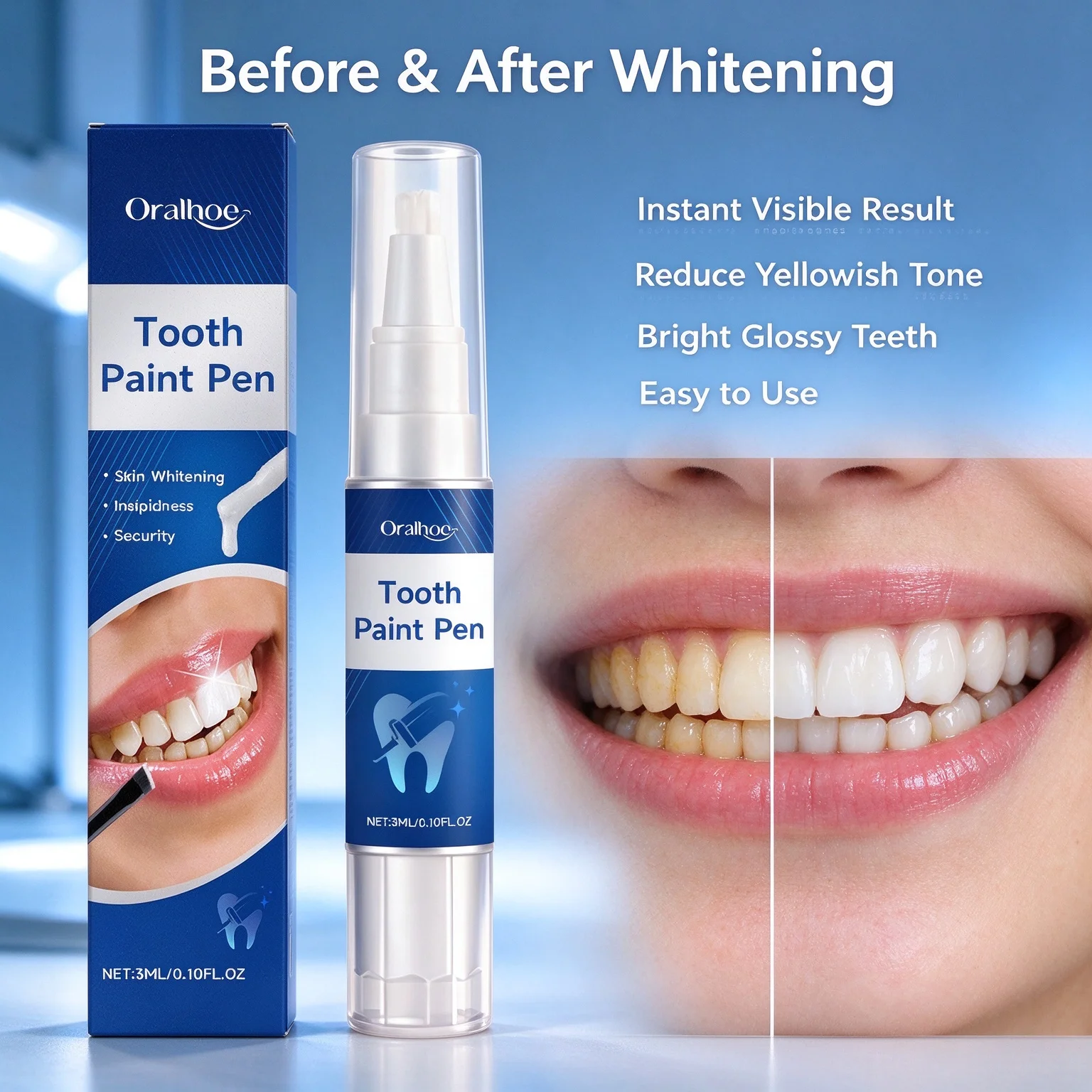 Teeth Whitening Pens - ORALHOE Tandenbleekpen Frisse Adem Verwijdert Slechte