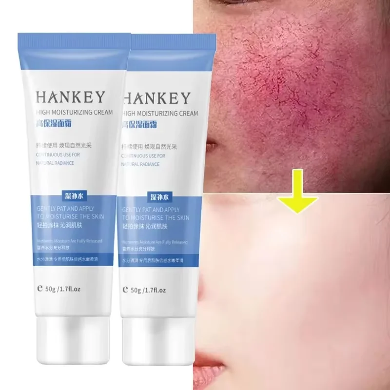 

Facial Redness Repair Cream Improve Sensitive Skin Dryness Moisturizing Hydrating Sooth Lotion Removal Rosacea Korean Cosmetics