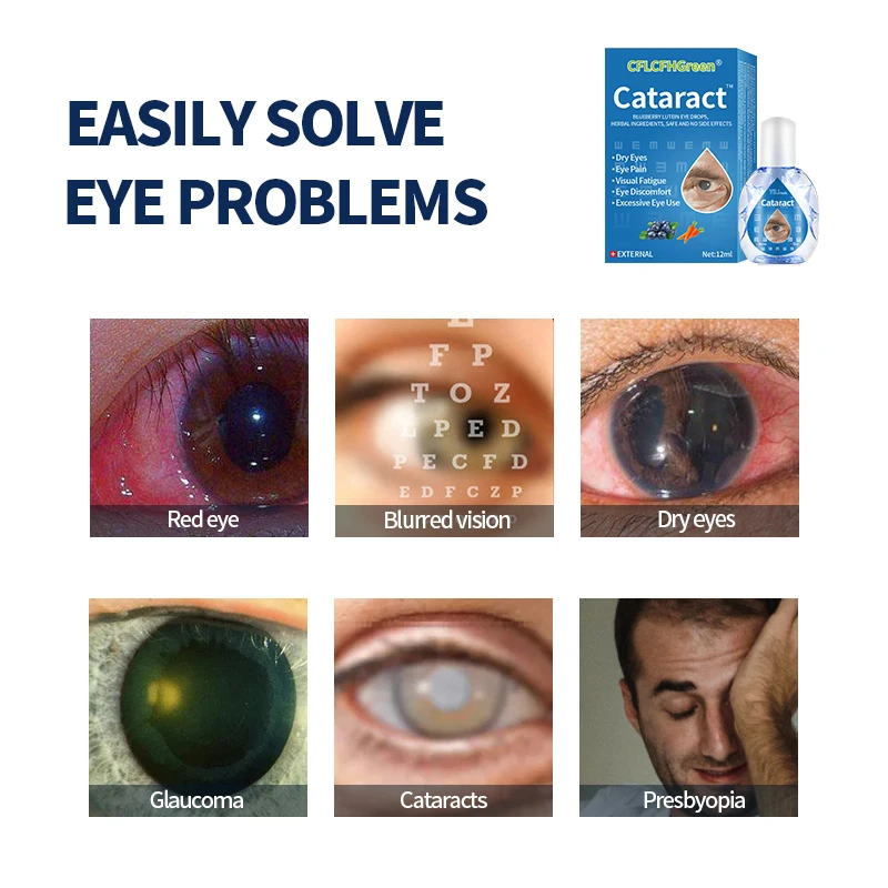 Cataract Cure Eye Drops Apply To Black Shadow Cloudy Eyeball Removal Blurred Vision Treatment Chinese Medicine 12Ml