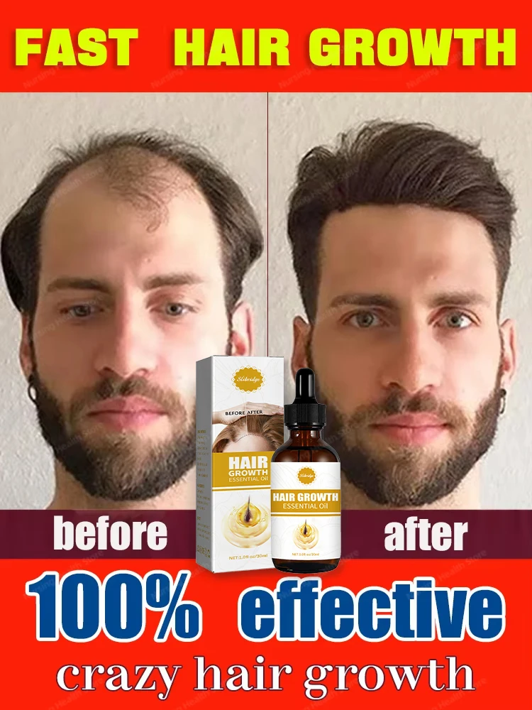 

99% of buyers buy again, have more and more hair, say goodbye to baldness, thick hair,Hot selling product