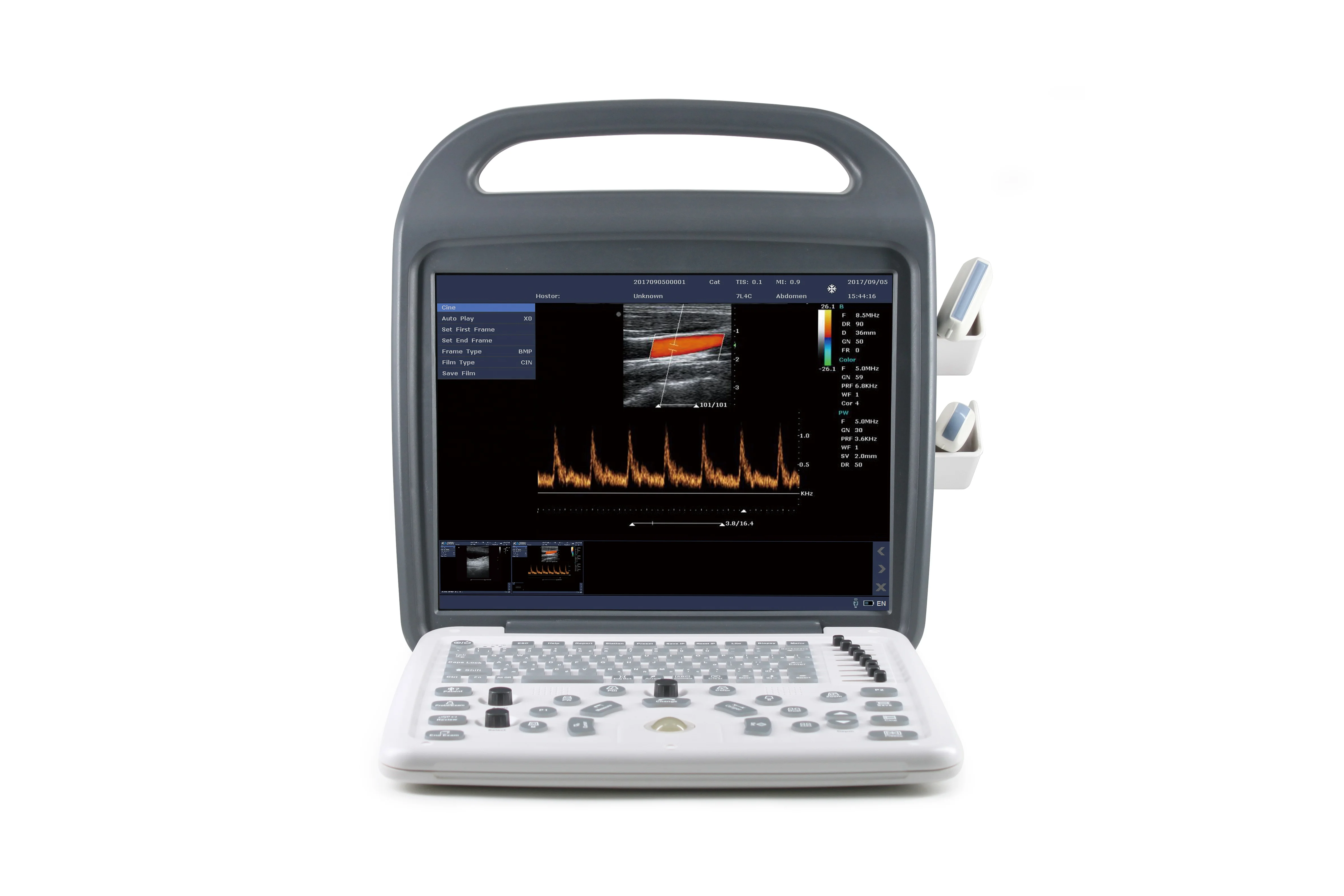 Professional Diagnostic Animal Heart Portable 2D Color Doppler Veterinary Ultrasound Scanner Machine