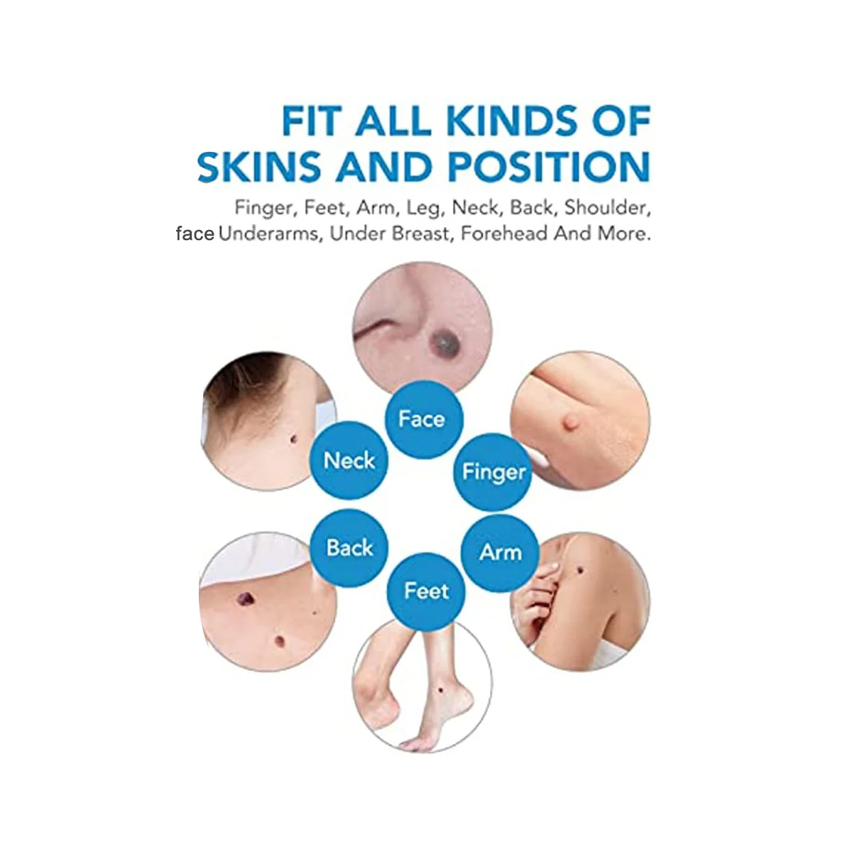 Indolor Auto Mole Verruga Remoção Kit, Cuidados Com A Pele, Corpo Verruga, Dot Tratamentos Removedor, Ferramentas De Limpeza, 2 em 1