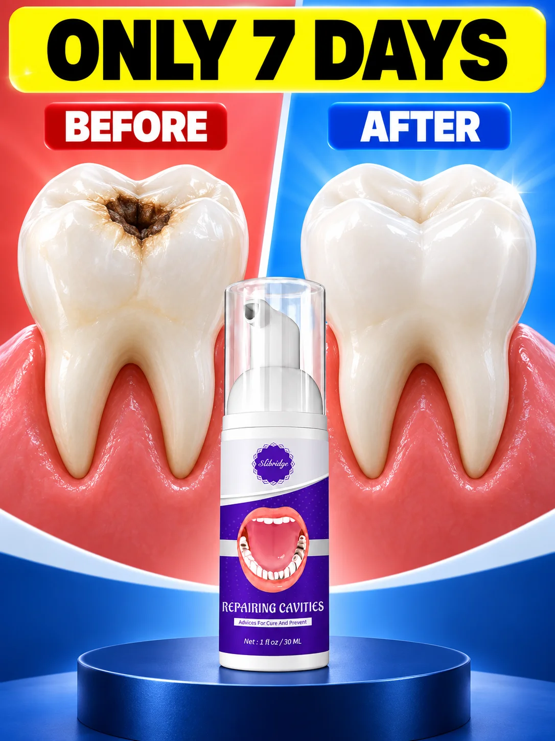 No More Food Getting Stuck in Those Little Tooth Corners Daily Oral Care