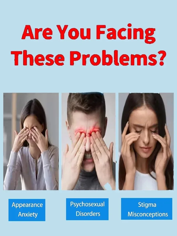 

[Новинка] Крем для удаления витилиго, средство для удаления витилиго, универсальный лосьон для тела, помогает позбутися от пота, витилиго, прозрачный витилиго кожи