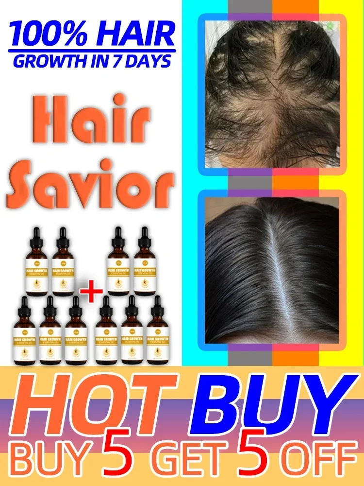 Essential oils that promote rapid hair growth and treat baldness and hair loss