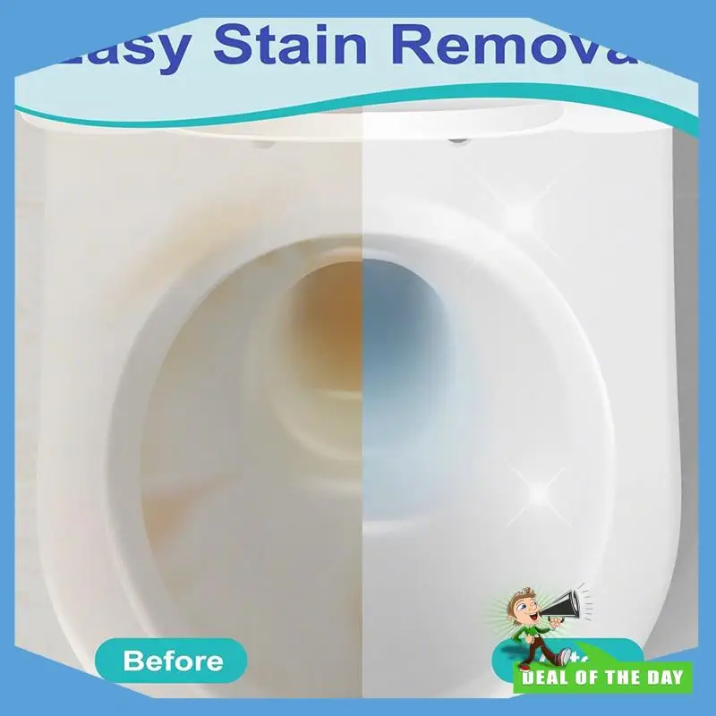 24-Hour Delivery Toilet Bowl Cleaner, 4PCS Pumice Stone With Extra Long Handle, 1 For Cleaning Handle For Toilets