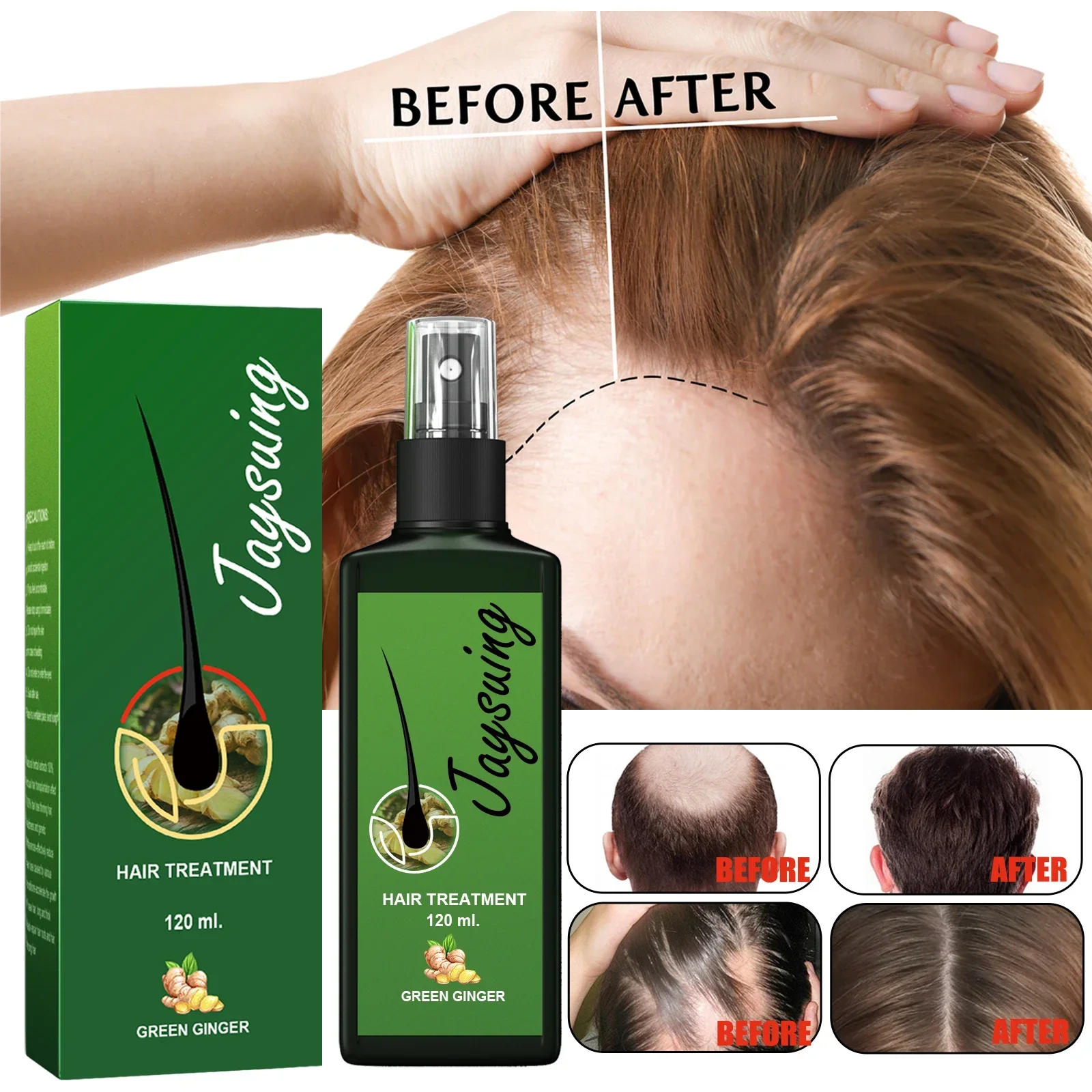 

Hair Growth oil Products Care Scalp Massage Treatments Anti Hair Loss Effective Grow Thicker Hair serum for men
