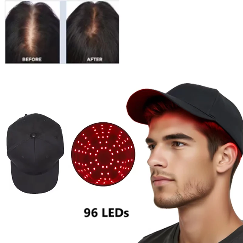 New 96Pcs Infrared LEDs 660nm&850nm Red Light Therapy Hair Growth Cap for Hair Regrowth Anti Hair Loss Relax Scalp Hair Care Hat