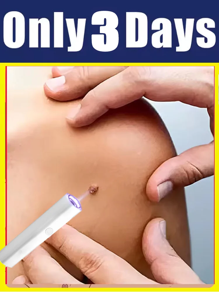 

1st ᵍᵉⁿᵉʳᵃᵗⁱᵒⁿ ᵘᵖᵍʳᵃᵈᵉᵈ wᵃʳᵗ ⸴ ʳᵉpᵃⁱʳ wᵃʳᵗˢ ʳᵒoᵗ ⸴ ᑫᵘⁱᶜᵏˡʸ 2025