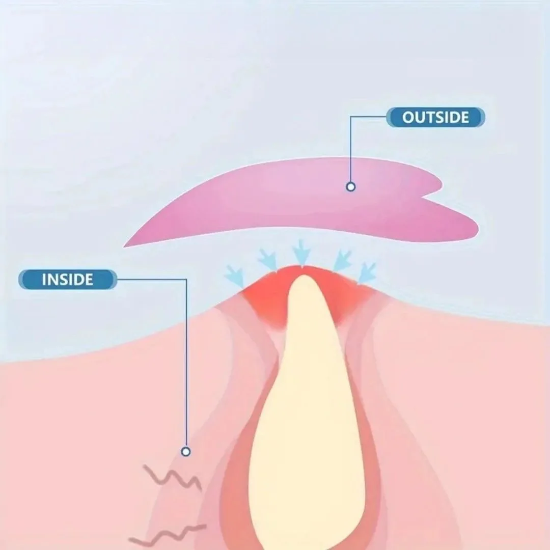 120 قطعة من رقعة البثور، نجمة صفراء لطيفة، ملصقات، مناسبة لجميع المناسبات، ضرورية للمكياج، كونسيلر