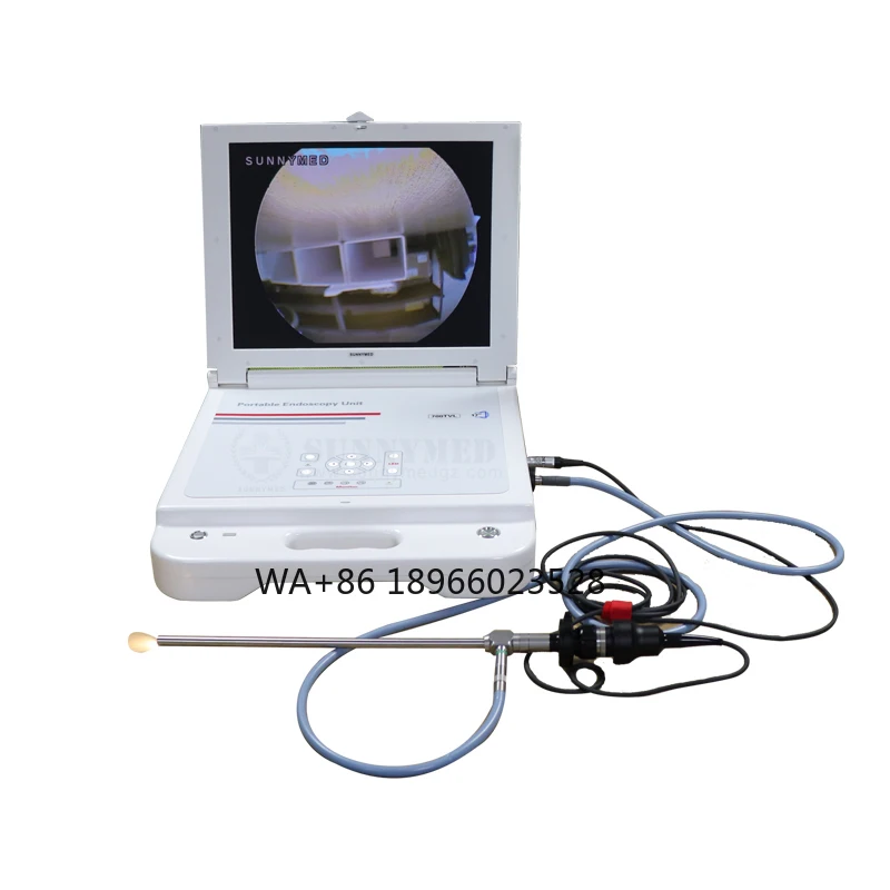 

SY-PS045N 17 Inch CCD Portable Light Source Endoscope System
