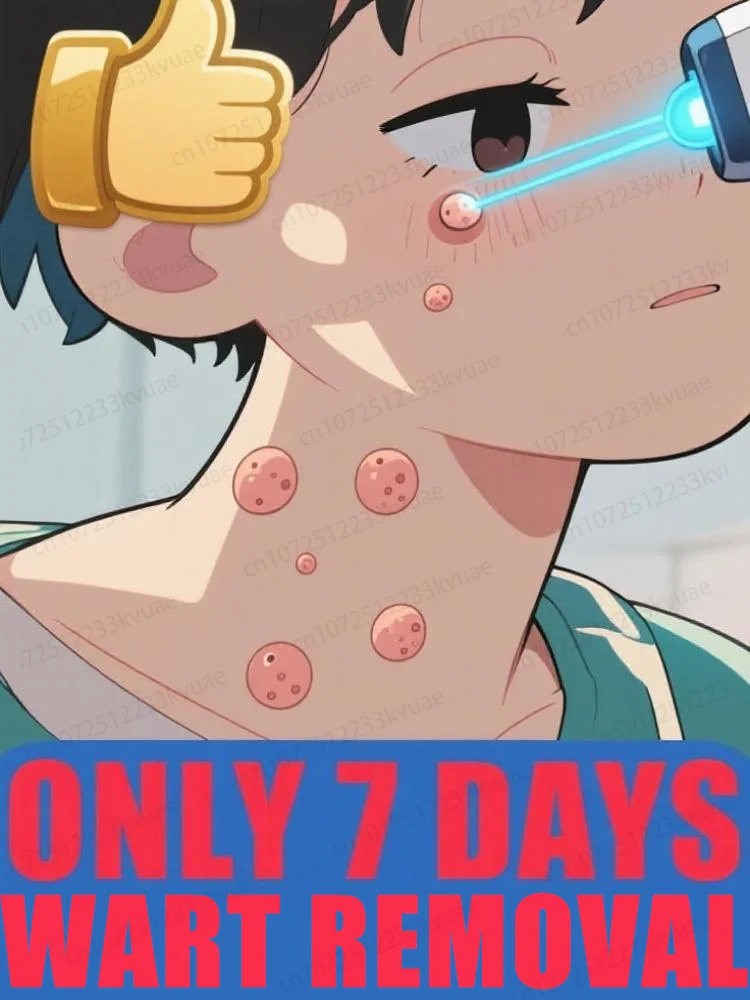 

Generation-2 Laser Says Goodbye To all warts In 7 Days