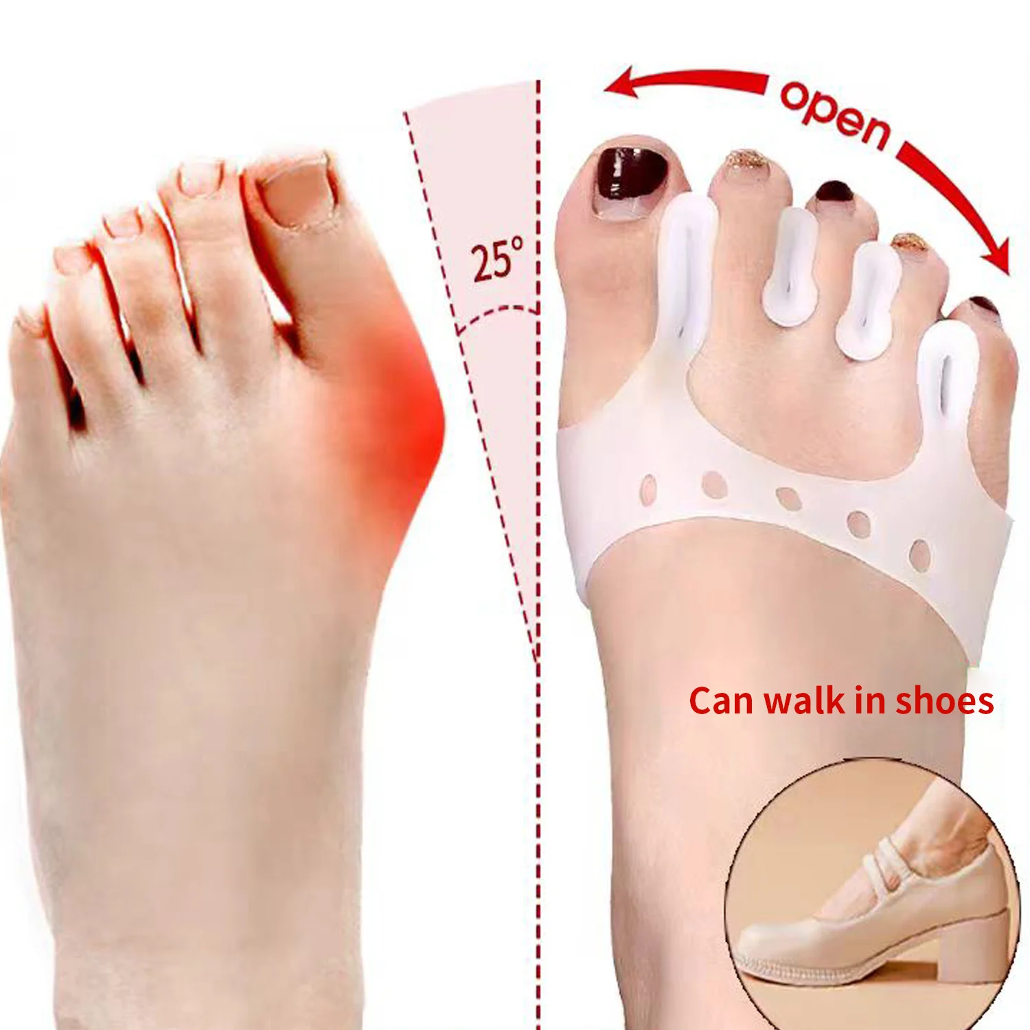 Corrector de juanete de silicona, separadores de dedos, transpirable, antideslizante, almohadilla suave para el antepié, tirantes ortopédicos, espaciadores ortopédicos para Hallux Valgus