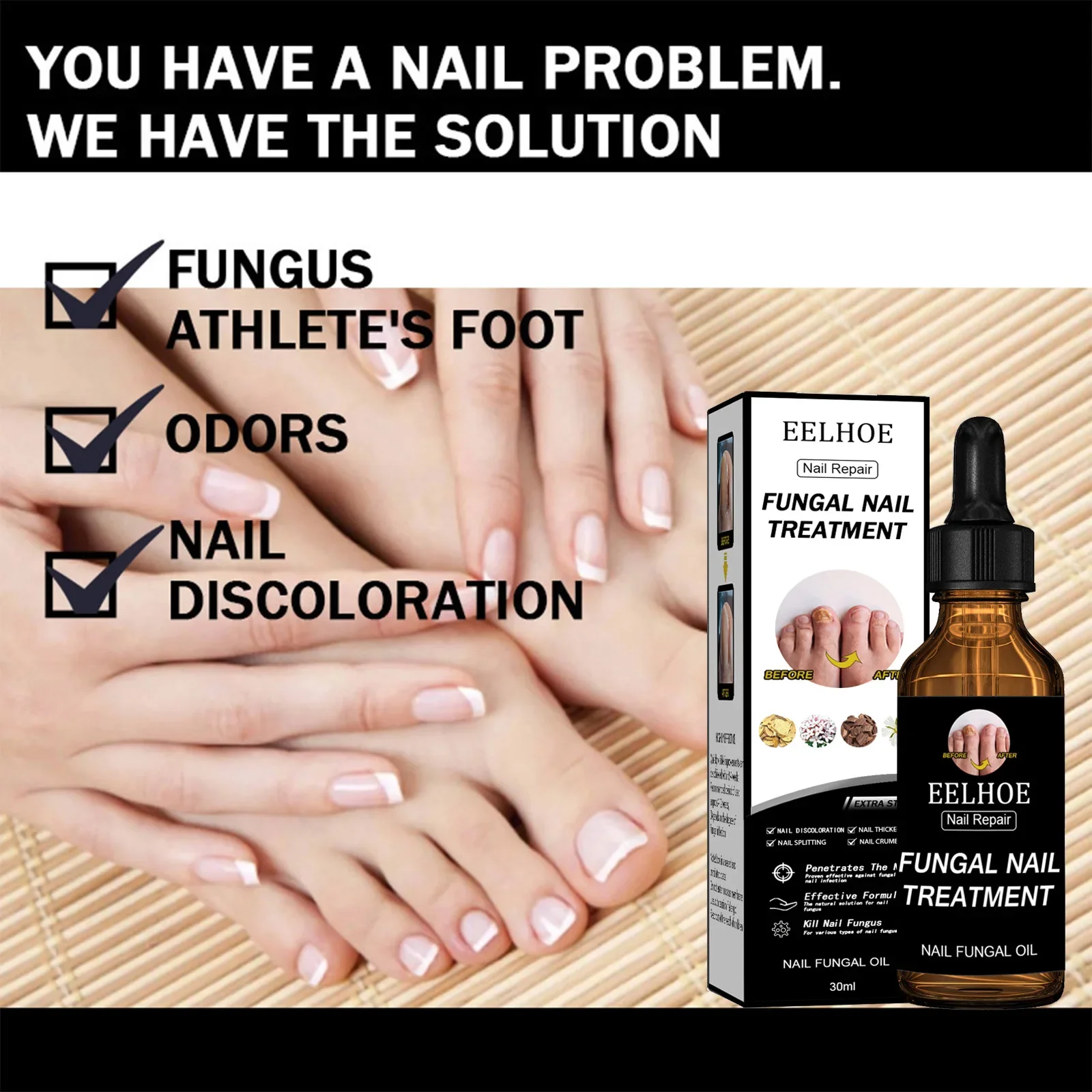 Toenail Care Nail Repair Solution Natural Nail Essence Fix Renew Damaged Molds Broken Cracked Discolored Nails Fast Repair Serum