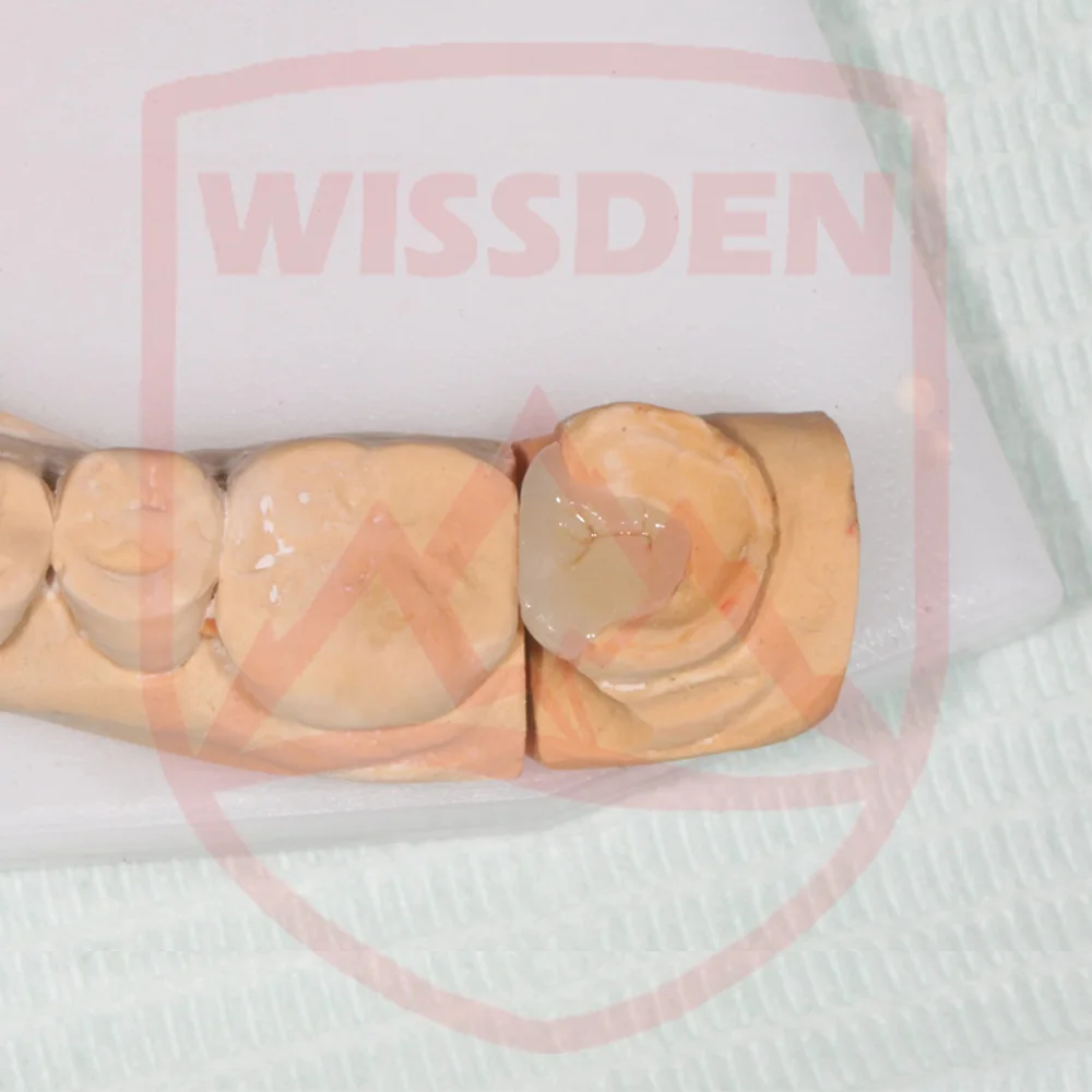 Wissden 5-teilige Presse für Dental, Glas, Keramikpresse, Lithium-Disilikatbarren, Materialien für Dentallabore