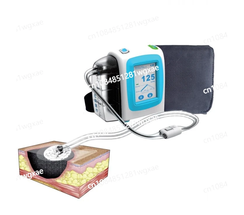 

Negative Pressure Wound Treatment System Equipment, Wound VAC Machine and NPWT Dressing Kit